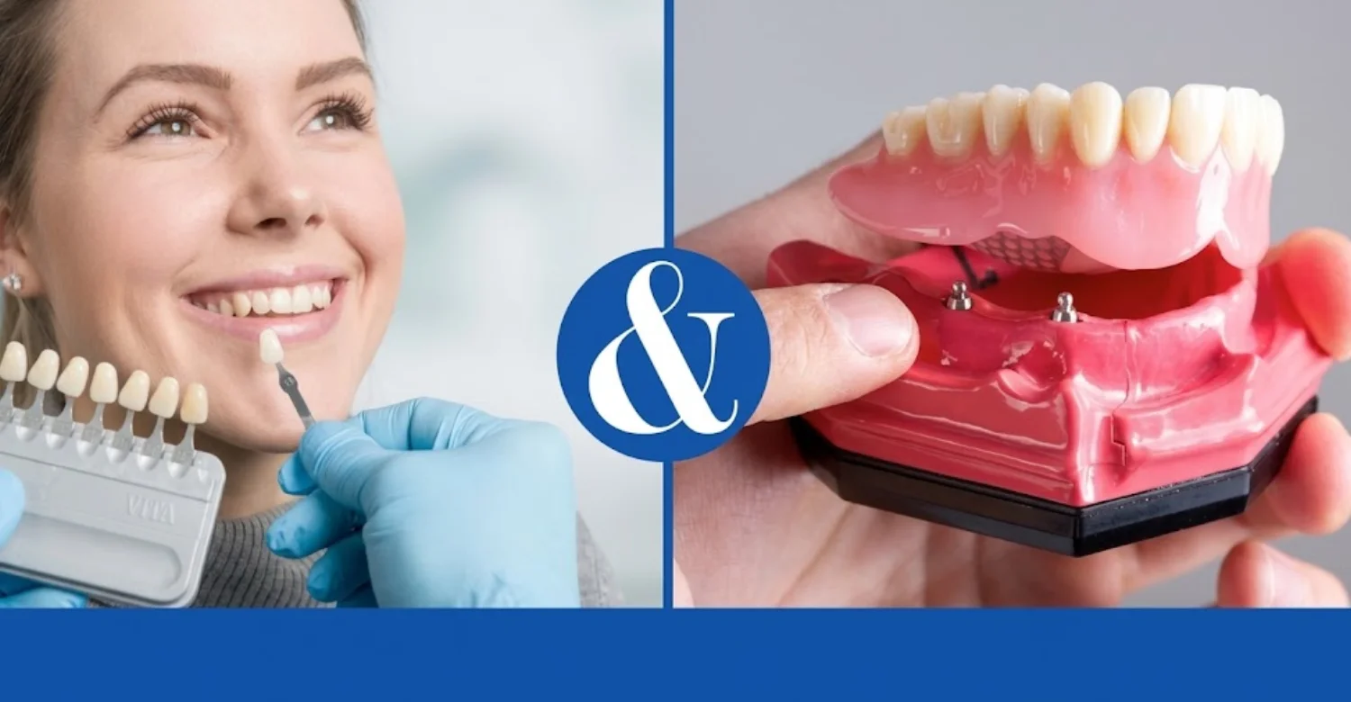 Veneers vs Dentures 2
